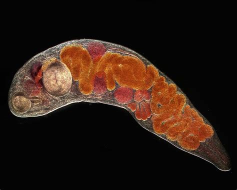  Irvingia Trematode：This Tiny Parasite That Makes a Big Splash in Freshwater Environments!